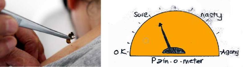 Bee Sting Pain Research