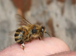 Honey Bee Stinging a Hand